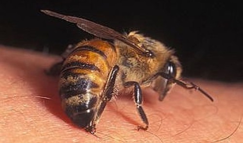 Лечение пчелами