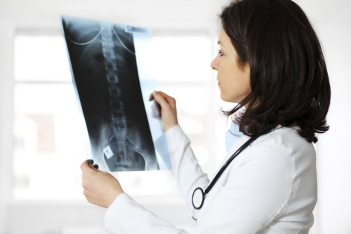 Рентген позвоночника - возможность выявить проблему на ранних стадиях!